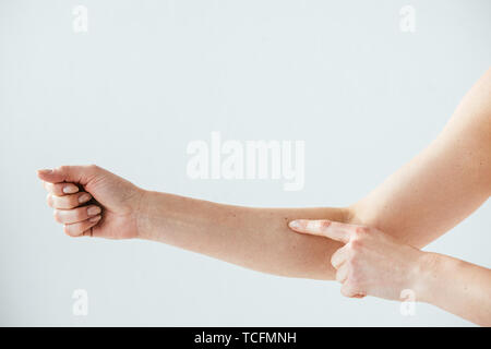 cropped view of woman pointing with finger at mole on white Stock Photo