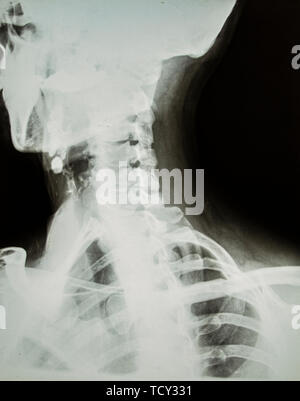 X-ray of a neck and head Stock Photo