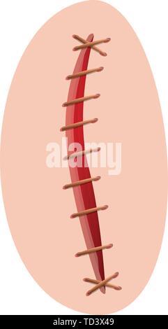 Suture icon. Cartoon of suture vector icon for web design isolated on white background Stock Vector