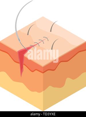 Surgical Suture Icon. Cartoon Of Surgical Suture Vector Icon For Web 