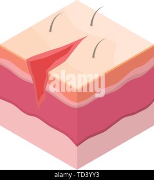 Open surgical suture icon, isometric style Stock Vector