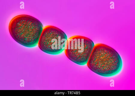 blue-green alga (Chroococcus spec.), blue-green algae from tessin, differential interference contrast, 120 x, Switzerland, Ticino Stock Photo