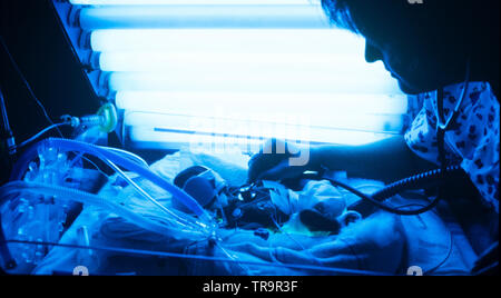 Bathed in blue ultraviolet light, a premature infant is monitored by a hospital neonatal intensive care nurse Stock Photo