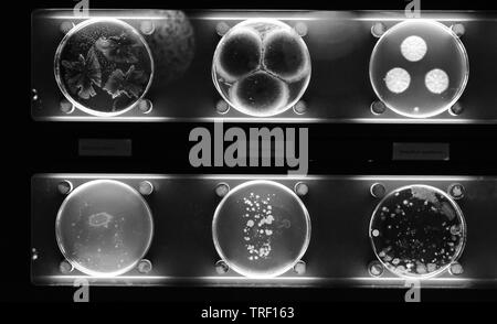 different samples with kinds of bacterias living at common household items. black and white. Stock Photo