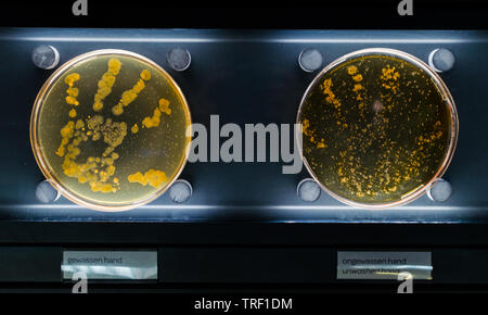 Unwashed and washed hand bacterias in petri dish. Stock Photo