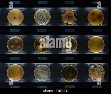 different samples with kinds of bacterias living at common household items- tothbrush, beard, nail brush. Stock Photo