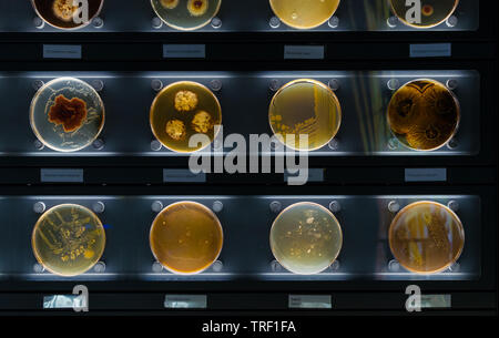 different samples with kinds of bacterias living at common household items- mattress, shoe, moisturizer. Stock Photo