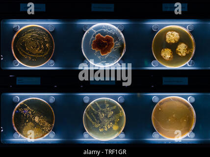 different samples with kinds of bacterias living at common household items- mattress, shoe, moisturizer. Stock Photo