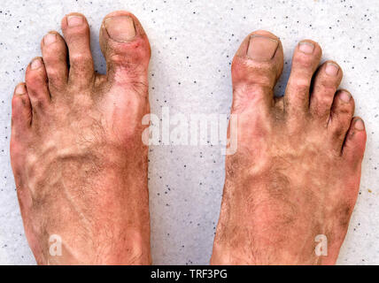 A pair of dirty sore male feet after a dusty and hot summer hike in outdoor sandals Stock Photo