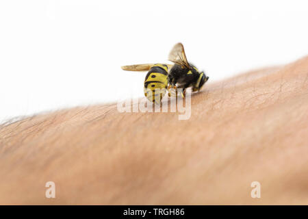 Bee stings in human skin, macro shot Stock Photo