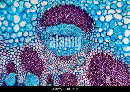 Greater Burdock, Arctium lappa, stem detail, brightfield photomicrograph Stock Photo
