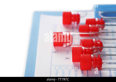 Test tubes and clipboard with medical history form close up Stock Photo