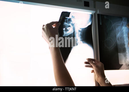 Cropped image of woman examining neck x-ray on diagnostic medical tool Stock Photo