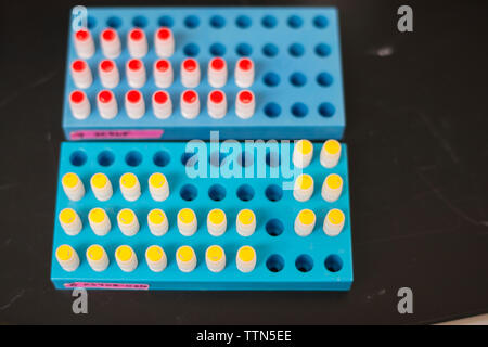 High angle view of medical samples in container on table at laboratory Stock Photo