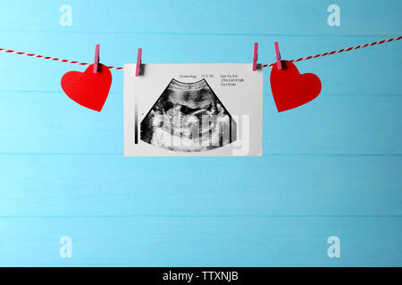 Ultrasound of baby hanging on rope Stock Photo - Alamy