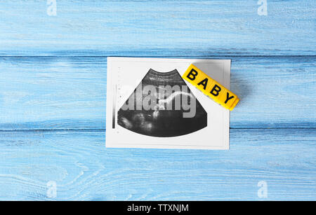 Ultrasound of baby on wooden background Stock Photo