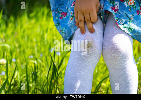 Dirty knees baby. A little girl shows off her stockings after falling on the grass Stock Photo