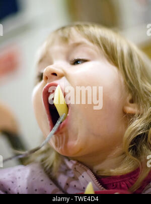 View into children mouth with white blue braces with central screw for  exact setting Stock Photo - Alamy