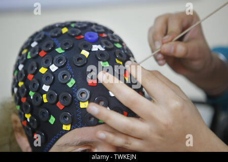 Bangalore, Karnataka, INdia. 13th Dec, 2018. 13 Dec 2018 - Bangalore, INDIA.A technician places a headgear with probes to pick up brain signals.During the scientific test when the chanting of the word 'AUM' is in progress; the various probes placed around the head pick up signals which are processed by a computer algorithm. These tests conducted at the NIMHANS (National institute of Mental Health and Neuro Sciences, Bengaluru) conclude that due to the sound vibrations created during the 'AUM chanting' phase the mind attains a deep state of relaxation. (Credit Image: © Subhash Sha Stock Photo