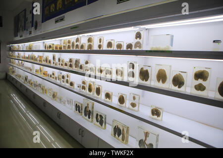 December 13, 2018 - Bangalore, Karnataka, INdia - 13 Dec 2018  - Bangalore , INDIA..View of the Brain Museum located in the NIMHANS Campus..The scientific  tests conducted at the NIMHANS (National institute of Mental Health  and Neuro Sciences, Bengaluru) conclude that due to the sound vibrations created during the 'AUM chanting'  phase the mind attains a deep state of relaxation. (Credit Image: © Subhash Sharma/ZUMA Wire) Stock Photo