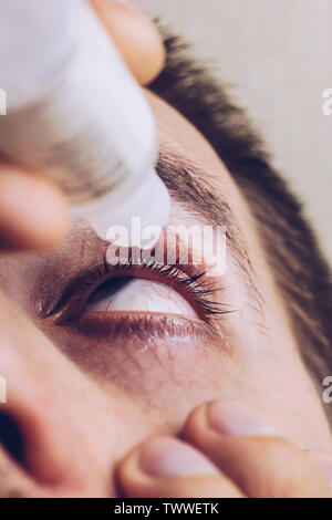 a man drips open human eye with bright red arteries drops to improve vision close up. irritation and redness of the eyeball. pupils, iris, eyelashes i Stock Photo