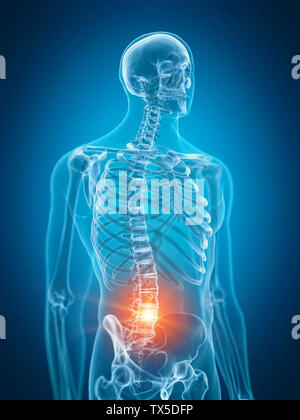 3d rendered medically accurate illustration of painful lower spine Stock Photo