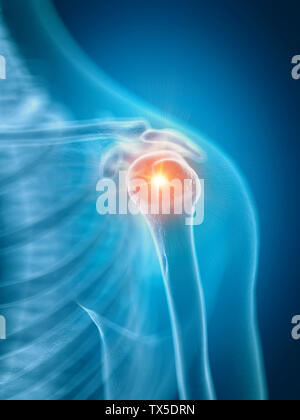 3d rendered medically accurate illustration of a painful shoulder Stock Photo