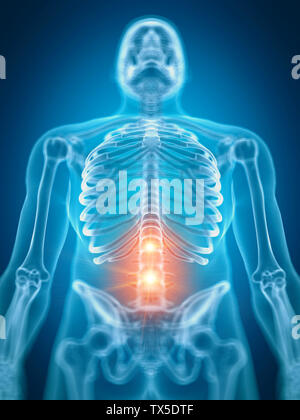3d rendered illustration of a painful lower spine Stock Photo - Alamy