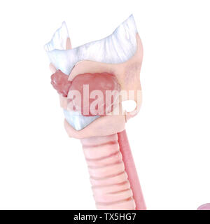 3d rendered, medically accurate illustration of larynx cancer Stock Photo