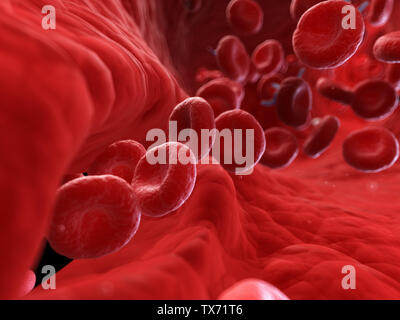 3d rendered, medically accurate illustration of an injured artery Stock Photo