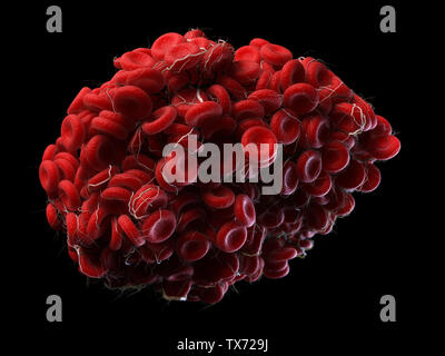 3d rendered, medically accurate illustration of a blood clot Stock Photo