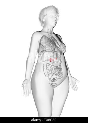 3d rendered medically accurate illustration of an obese womans pancreas Stock Photo