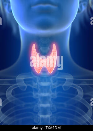 3d rendered medically accurate illustration of an inflamed thyroid gland Stock Photo