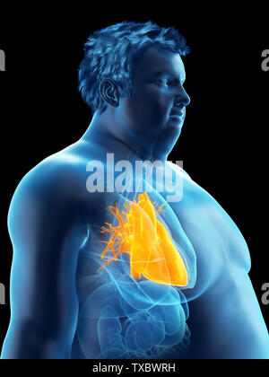 3d rendered medically accurate illustration of an obese mans heart Stock Photo