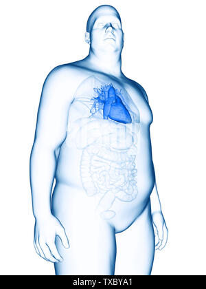 3d rendered medically accurate illustration of an obese mans heart Stock Photo