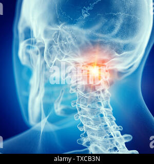 3d rendered medically accurate illustration of a painful atlas Stock Photo