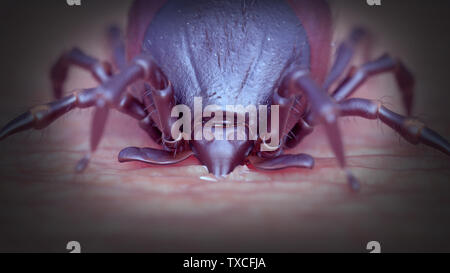 3d rendered illustration of a tick biting a human Stock Photo