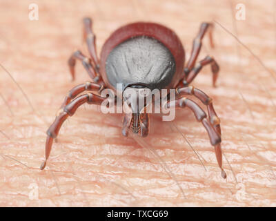 3d rendered illustration of a tick crawling on human skin Stock Photo