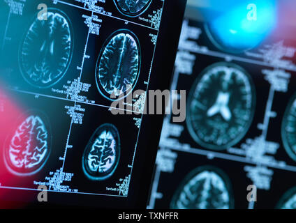 Brain scans of possible disease or damage in clinic Stock Photo