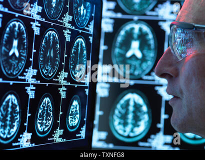 Doctor viewing brain scans for possible disease or damage in clinic Stock Photo