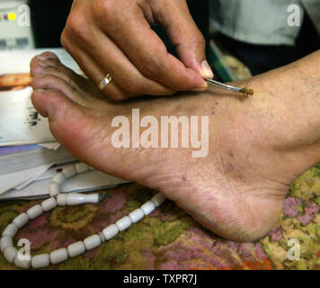 Palestinian bee and honey expert Rateb Samor 52  year,  stings stings a man (no name) with bee in his foot, as he treats her from swelling May 10, 2006 at his clinic in his home in Gaza City, Gaza Strip. Samor and his wife Oum Ebrahem are two Muslim experts who perform the Muslim Holy Quran book treatment of the Honey and Bee Stings to treat most critical illnesses like Paralysis, Nasal Sinuses, Rheumatism, deafness, visually impaired, infertility, chronic back pain, chronic diseases, and other serious diseases. The treatment with honey and bee stings is supposedly the way the Prophet Mohammad Stock Photo