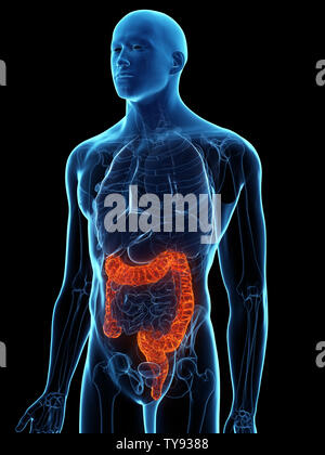 Inside of an unhealthy colon Stock Photo - Alamy