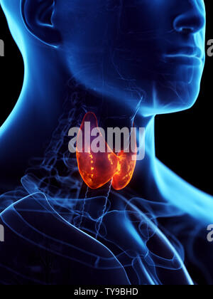 Inflamed thyroid gland, illustration Stock Photo - Alamy