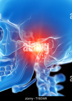 3d rendered medically accurate illustration of the temporomandibuar joint showing pain Stock Photo