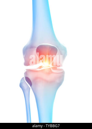 3d rendered medically accurate illustration of the knee joint showing pain Stock Photo