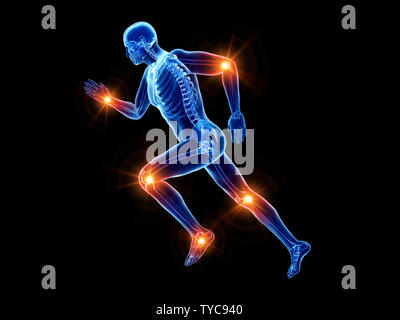 3d rendered illustration of a joggers painful joints Stock Photo