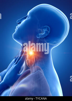 3d rendered medically accurate illustration of a man having a sore throat Stock Photo