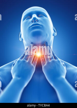 3d rendered medically accurate illustration of a man having a sore throat Stock Photo