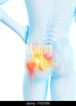 3d rendered medically accurate illustration of a man having a painful hip joint Stock Photo