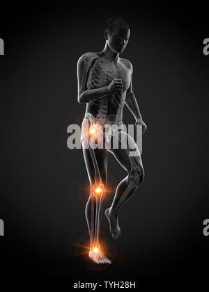 3d rendered medically accurate illustration of a walking man with painful jonts Stock Photo